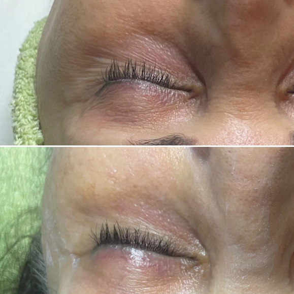 Youth Skin Ritual Anti-Aging & Firming Treatment