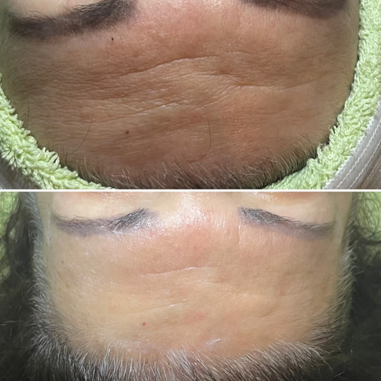 Rejuvenize Peel