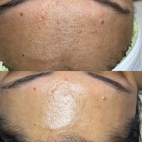 Illuminize Peel