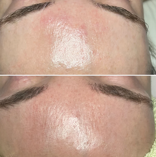 Vitalize Peel