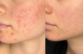 Clarifying Skin Ritual